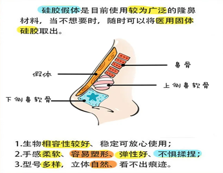 沈阳隆鼻价格多少？沈阳隆鼻口碑医院一一列出
