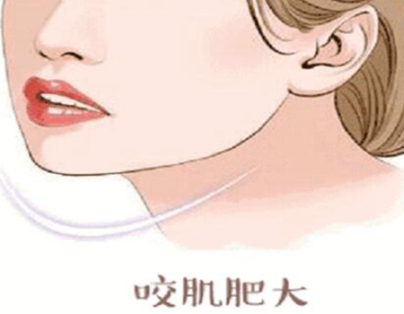上海磨颧骨价格多少钱 ？磨骨资费-医院推荐一览