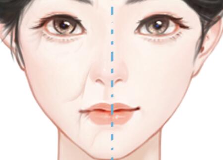 长沙做拉皮需要多少钱？人气医美医院名单查看