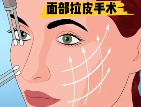 福州面部大拉皮手术多少钱？整形医院哪些好？戳进来看