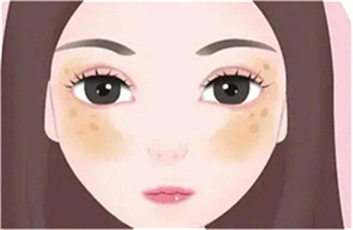 激光13.jpg