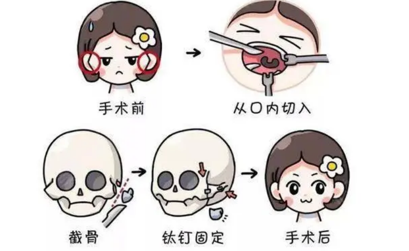 微信截图_20240427062418.png