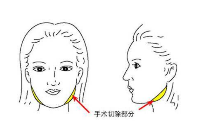 微信截图_20240427064935.png