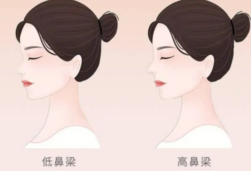 合肥禾丽整形医院隆鼻怎么样？隆鼻整形体验感受|医生资料