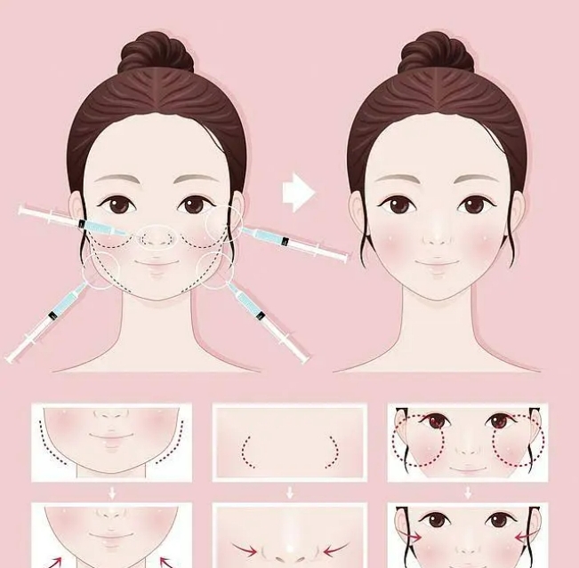 微信截图_20231205101257.png 微信截图_20231205101257.png