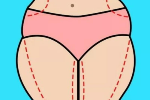 共振吸脂瘦大腿效果明显吗
