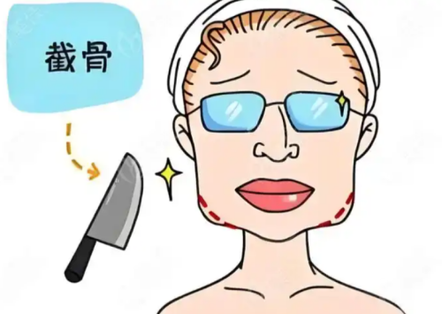 饶平县人民医院整形科下颌角磨骨怎么样？安全改脸塑轮廓