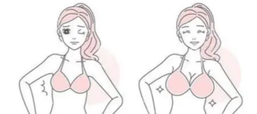 深圳市龙华区人民医院隆胸价格公示！真实案例与收费全解析