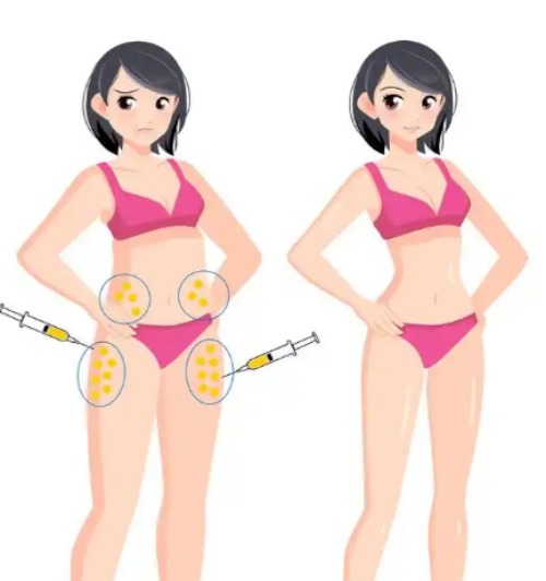 中山三院整形美容科吸脂好不好？实力审美在线！
