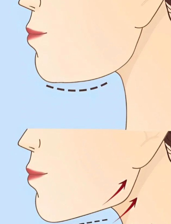 屏幕截图 2026-03-22 181247.png