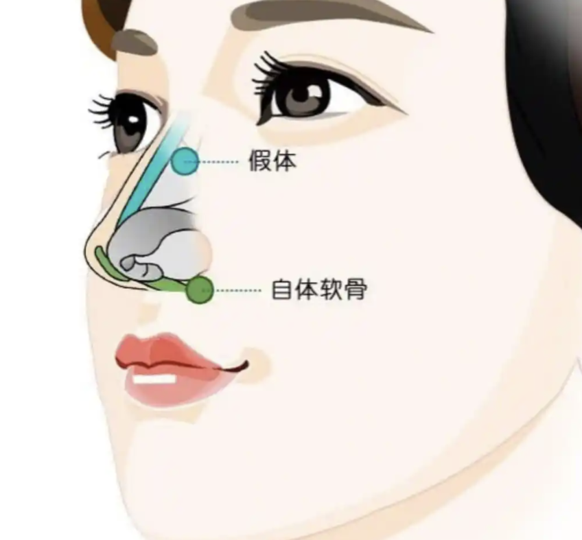 image.png image.png