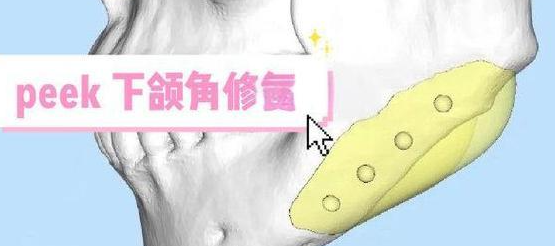 image.png image.png