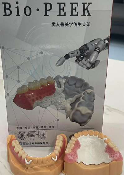 peek义齿支架价格多少钱，了解项目注意事项