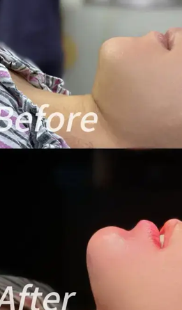 peek下巴多少钱，推荐收藏