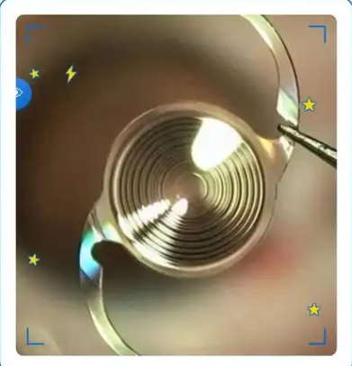 image.png image.png