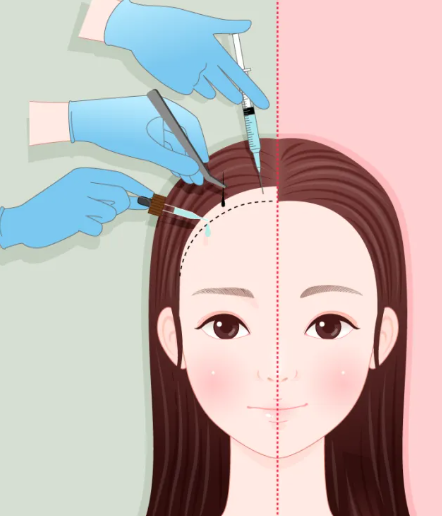 幼态脸需要做哪些项目，获取详细介绍