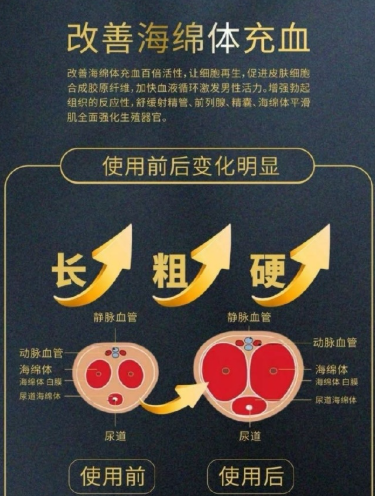 黄金自生原液是自体脂肪吗，专业顾问在线解答