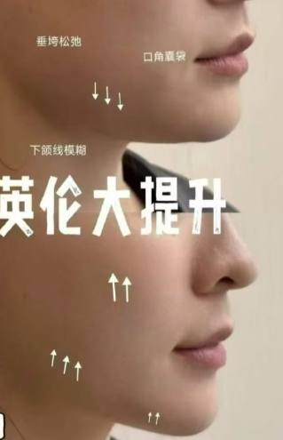 英伦大提升和线雕哪个效果好，效果对比、直观可见