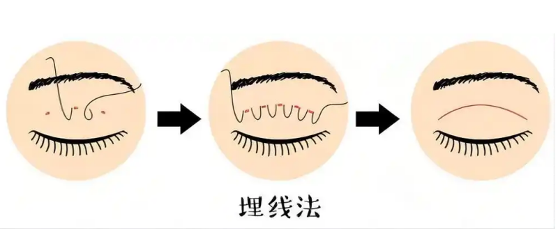 ffb667d8cb4a863e3e0e5f9fe7c4eee4.png